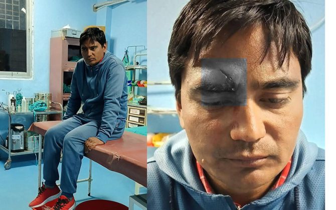 चक्कु प्रहार