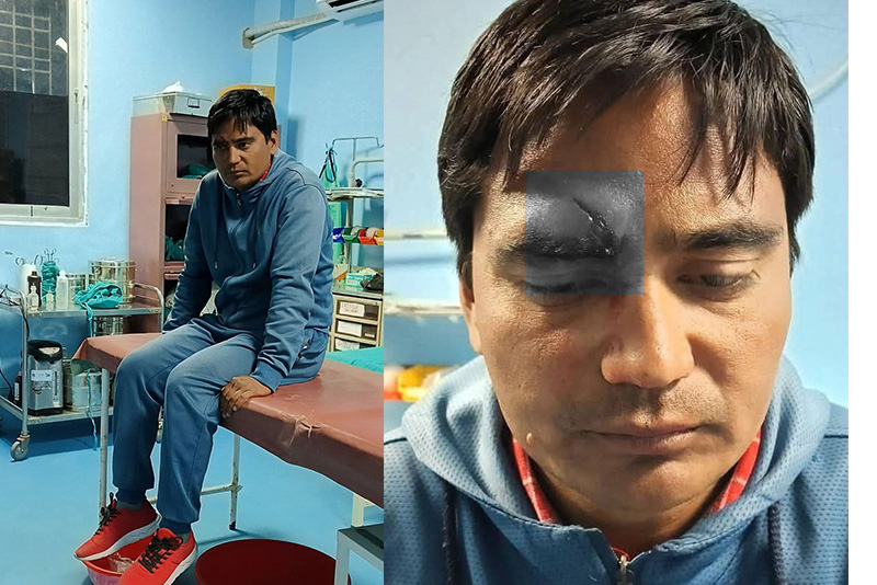 चक्कु प्रहार