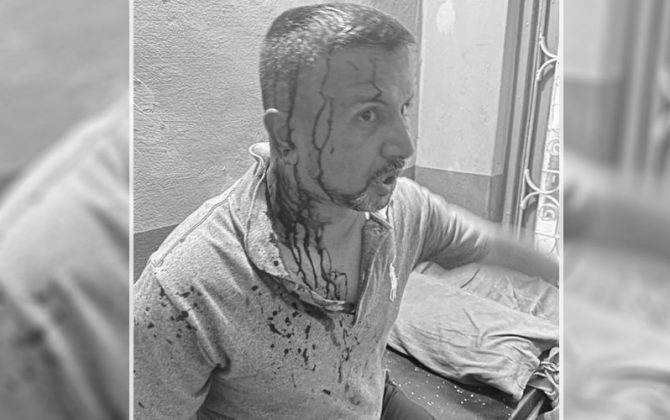 युवा संघ पर्वतको अधिवेशनमा झडप, एमाले प्रदेश सदस्य पौडेल घाइते